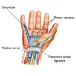 Hand and Wrist Disorders